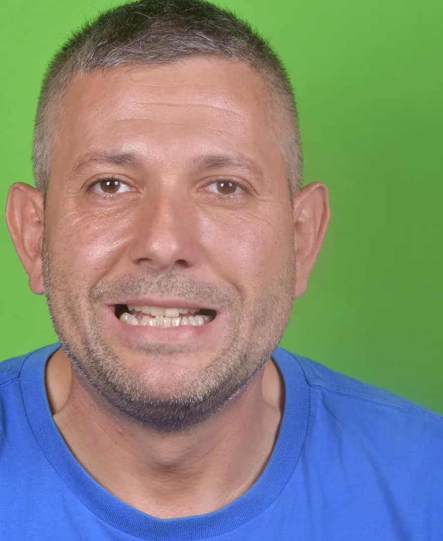Zirkonyum — Öncesi