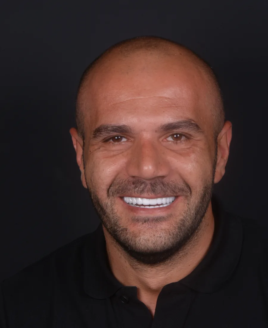 Zirkonyum — Sonrası